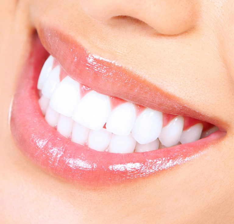 Photo of a woman's perfect teeth