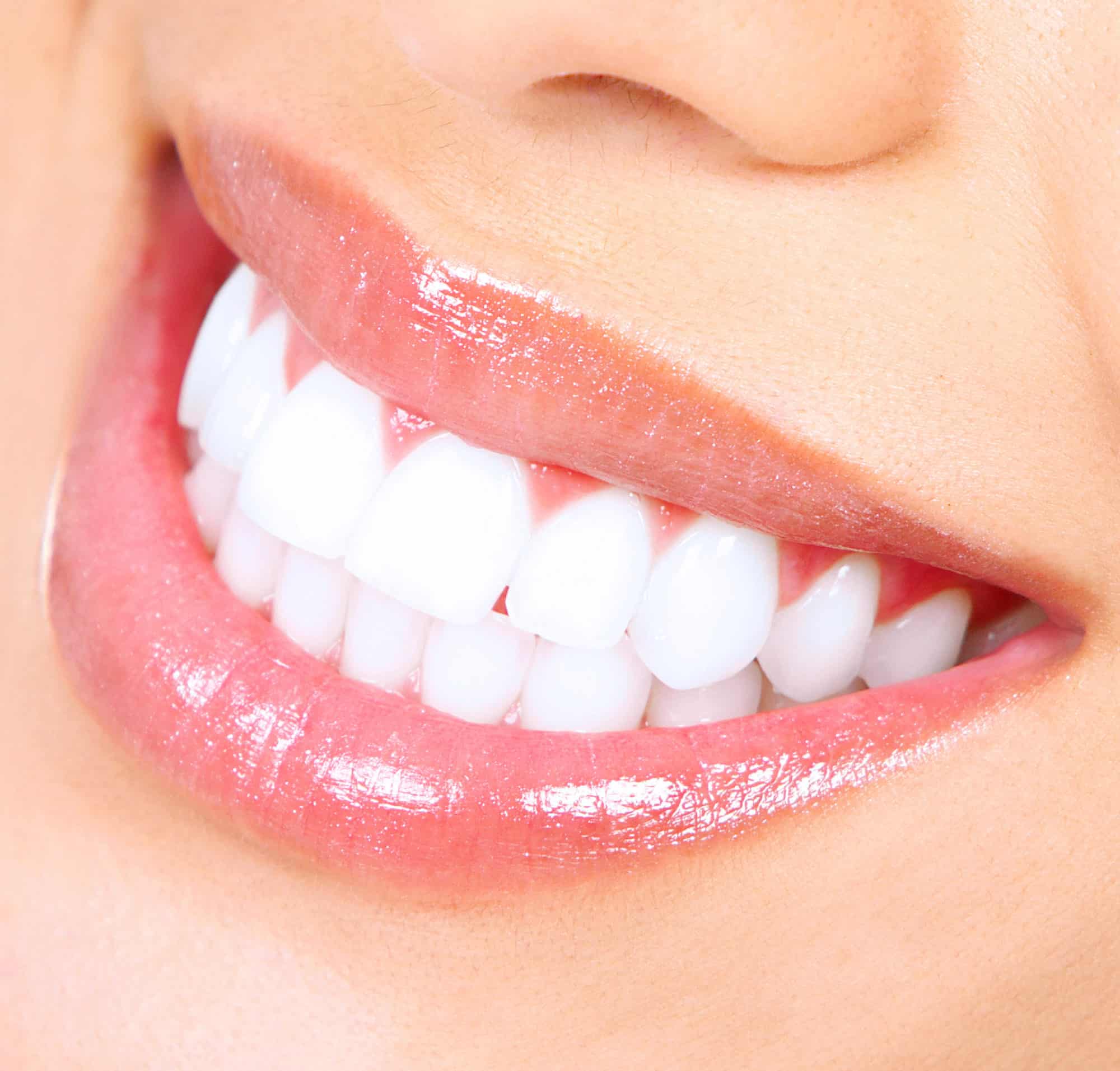 Photo of a woman's perfect teeth