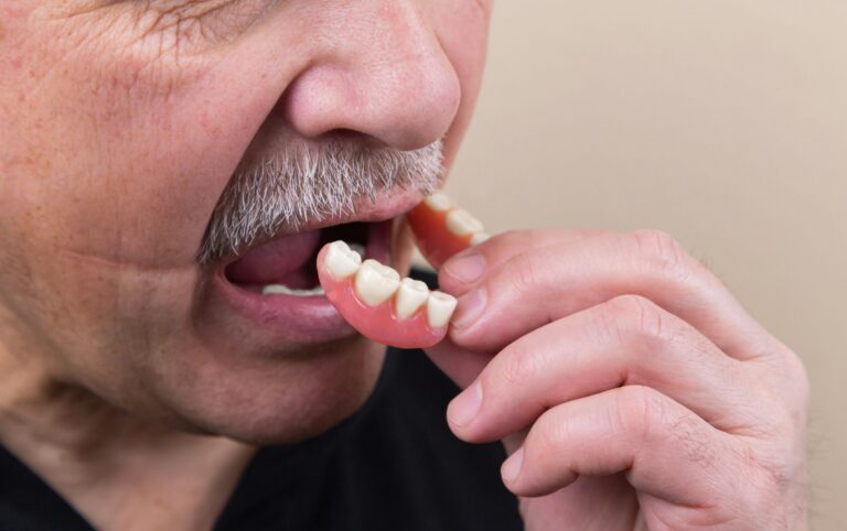 ill fitting denture